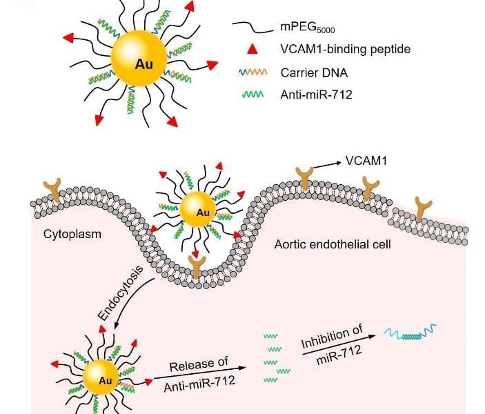 targeted-gene-delivery-for-the-treatment-of-atherosclerosis-advanced