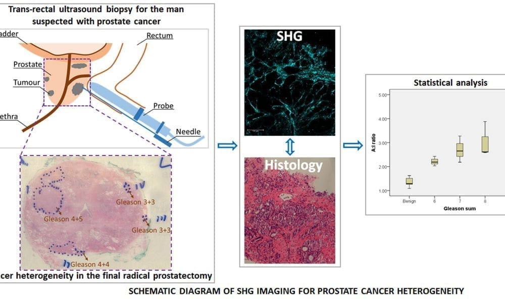 Improving Prostate C