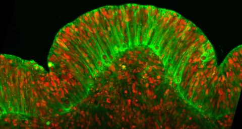 Live-Imaging of Human Brain Organoids - Advanced Science News