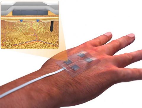 Smart Bandage To Heal Chronic Wounds - Advanced Science News