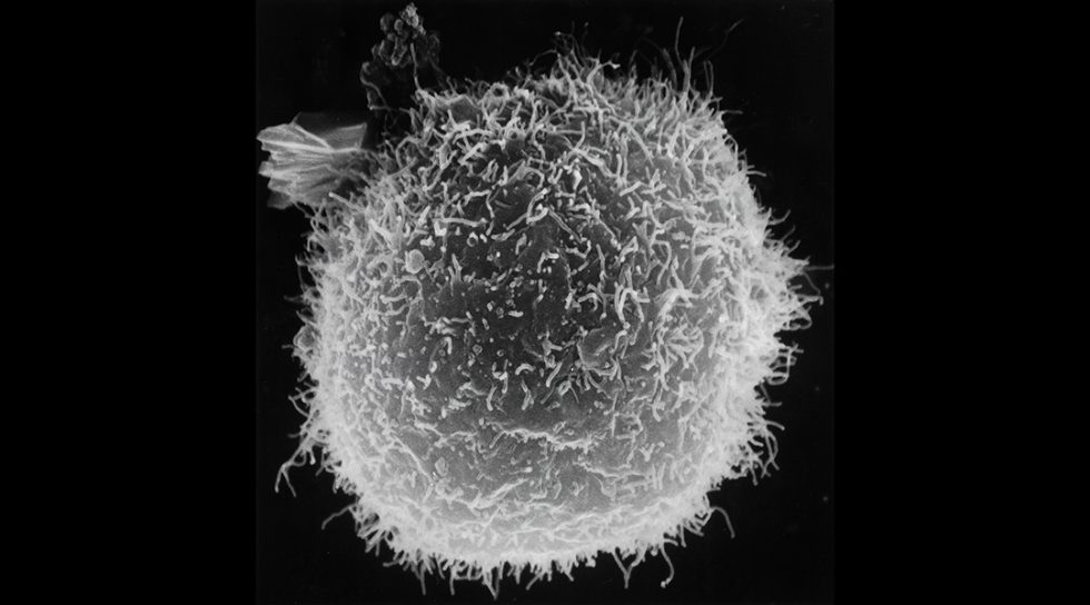 Nanoparticles that self-assemble inside cells to fight cancer ...