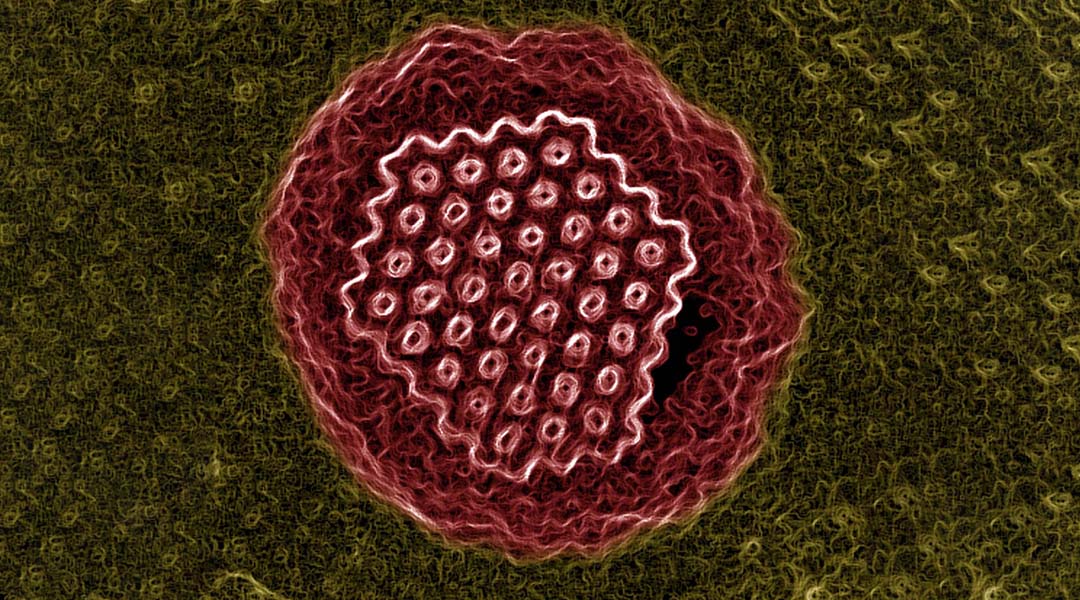microscopic virus