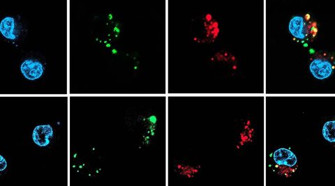 SiRNA Therapies Delivered With Oral Nanocapsules - Advanced Science News