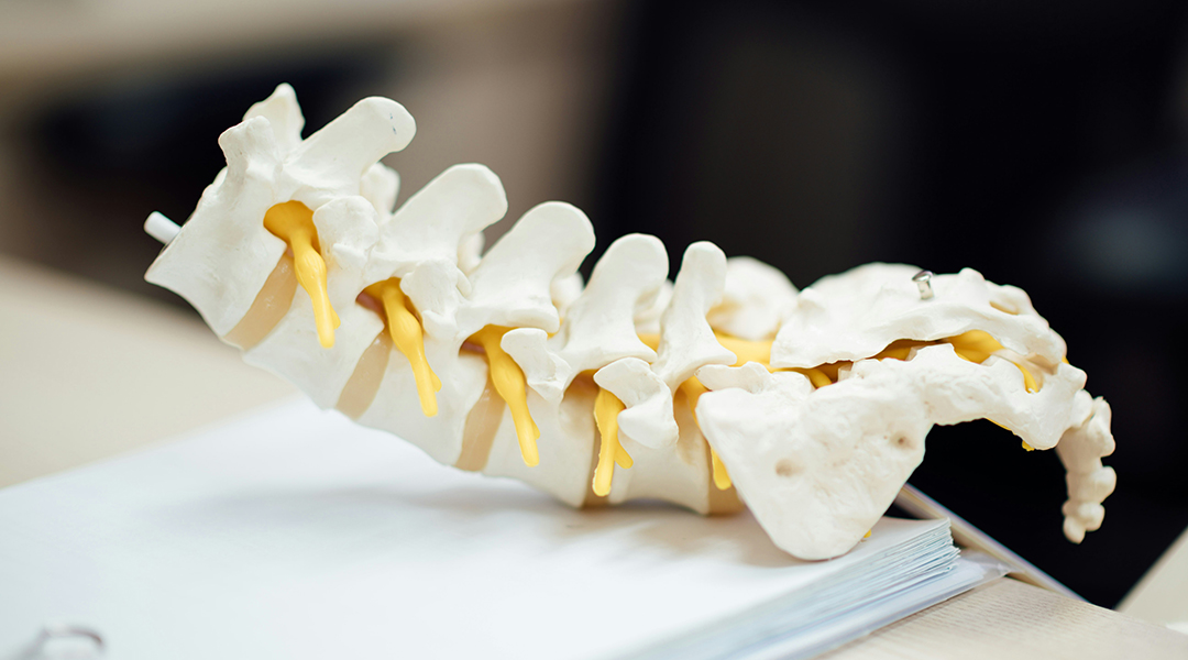 Using 3D printing to treat bone infections