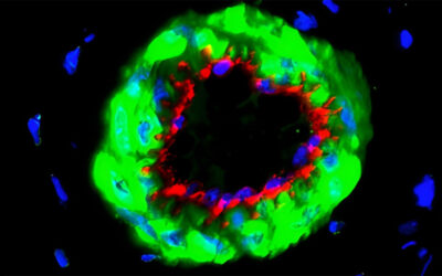 Tiny vesicles could help prevent amputations in diabetic patients