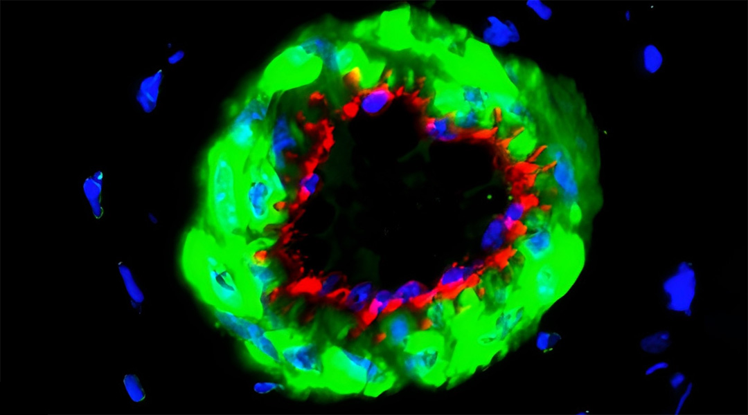 Image showing muscle cell growth under influence of new therapy.