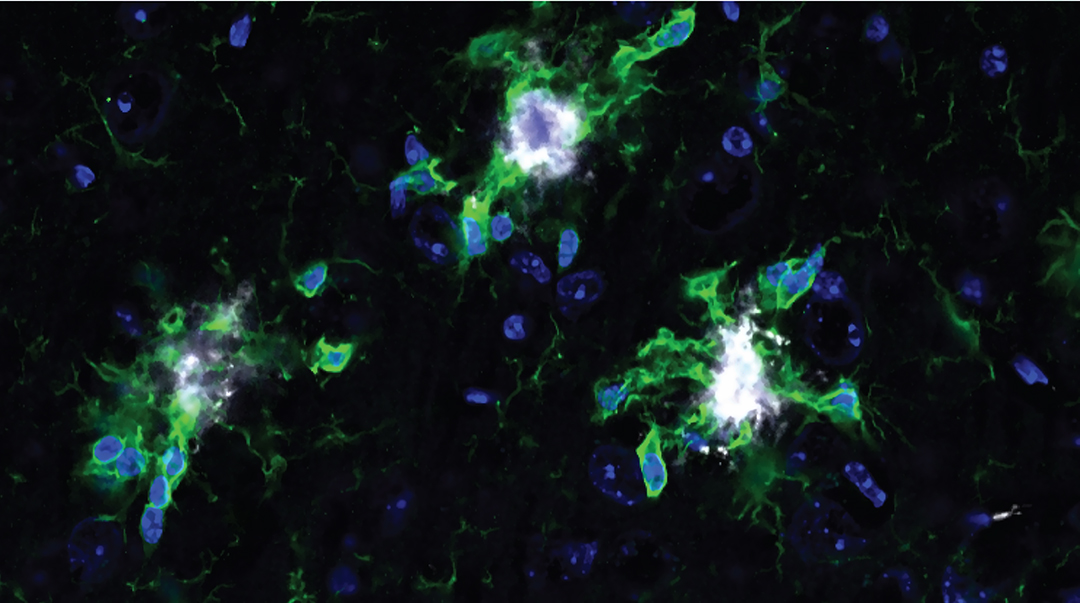 Image of treated brain cells using xenon gas.