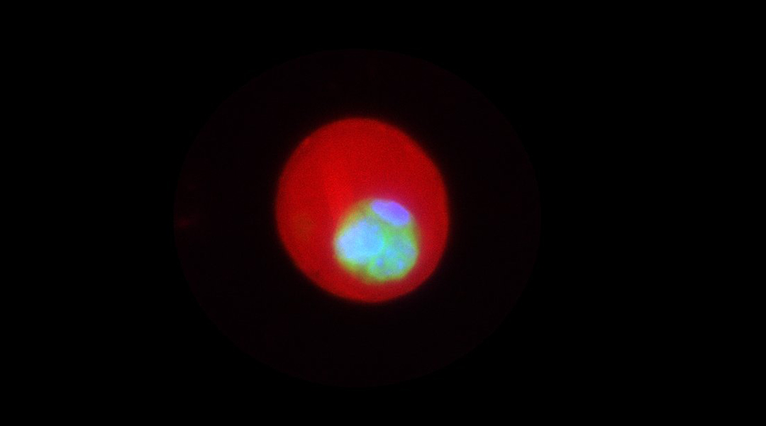 Experimental image of cells encapsulated within a microgel.