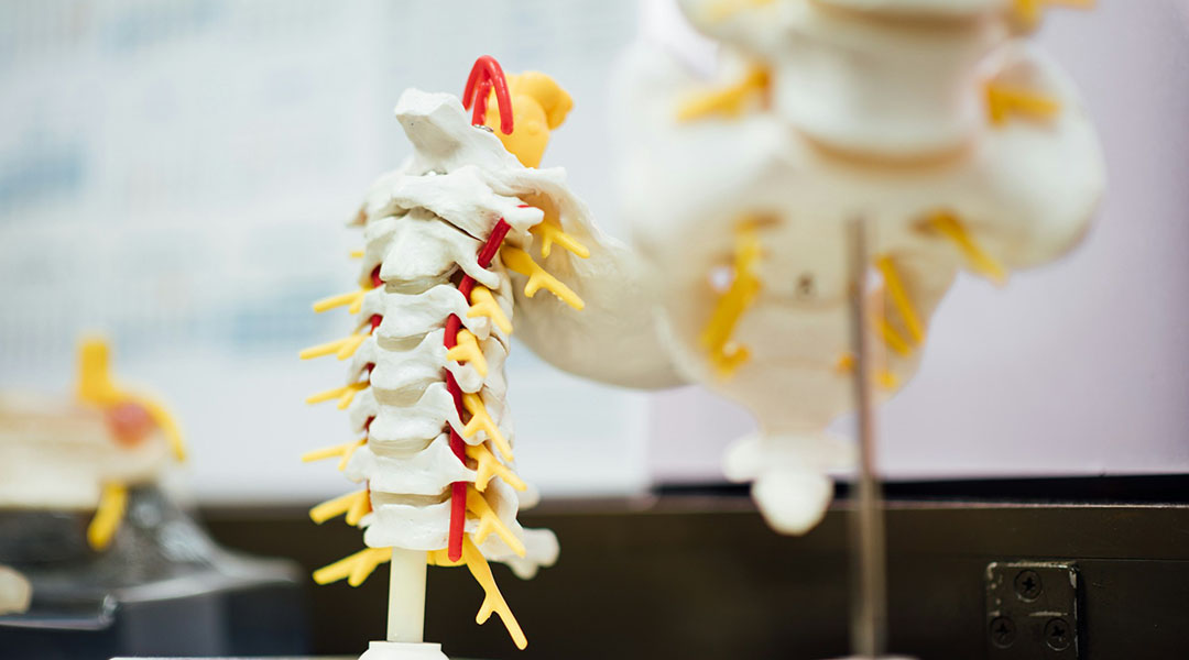 A new biomaterial shields nerves from inflammation, aiding spinal cord injury