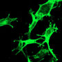 Confocal image of B16F10 cells expressing RBD antigen.